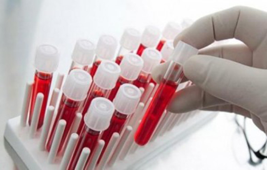 Trombosit Değerleri Nelerdir?