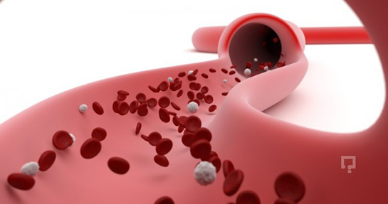 Trombosit Yüksekliği Belirtileri ve Tedavisi